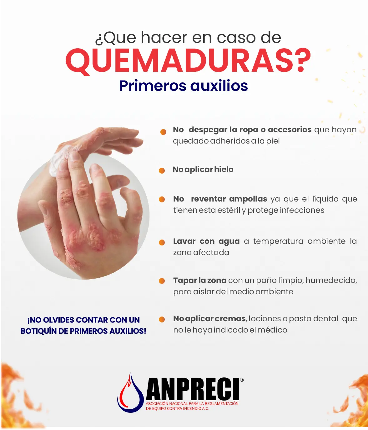 Que-hacer-en-caso-de-quemaduras